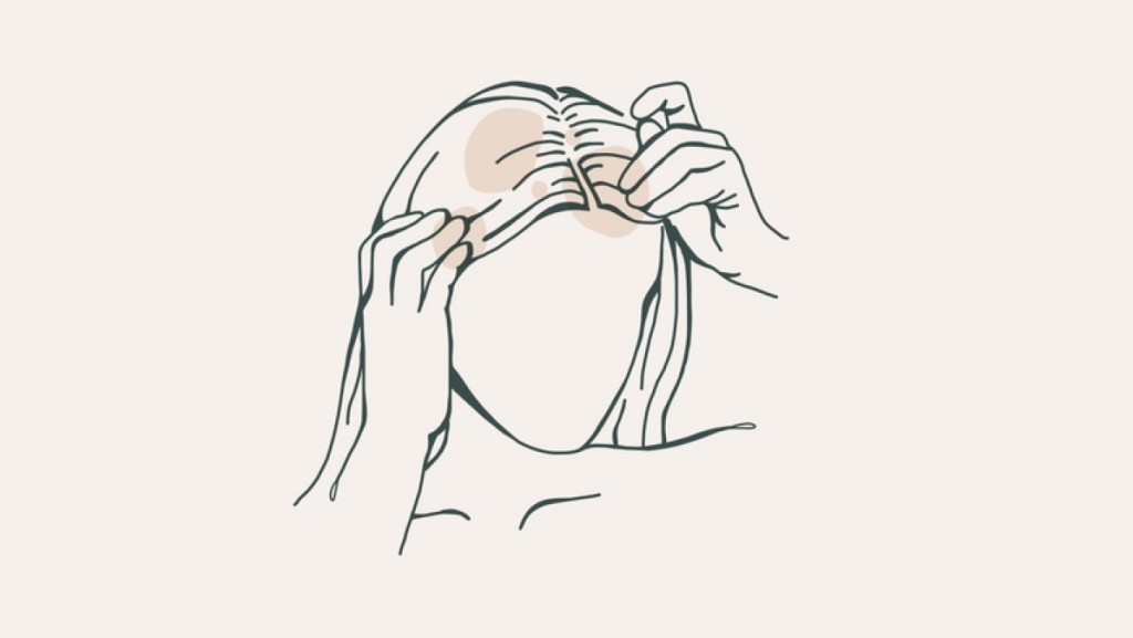 Irritierte Kopfhaut - Herausforderungen und Lösungsansätze