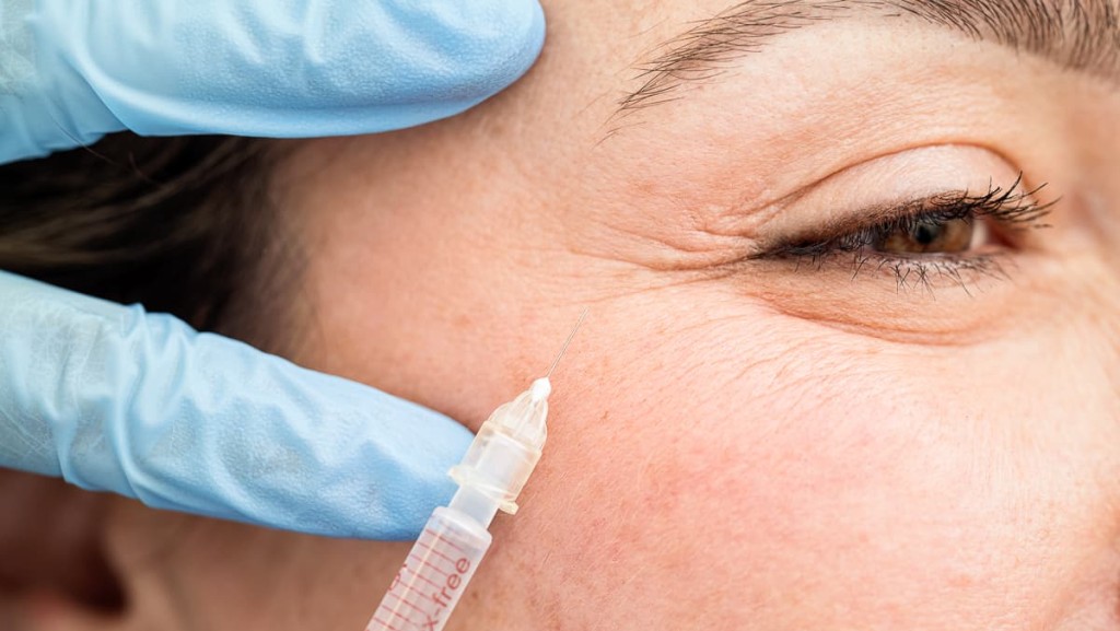 Botox: Herkunft und ästhetische Revolution