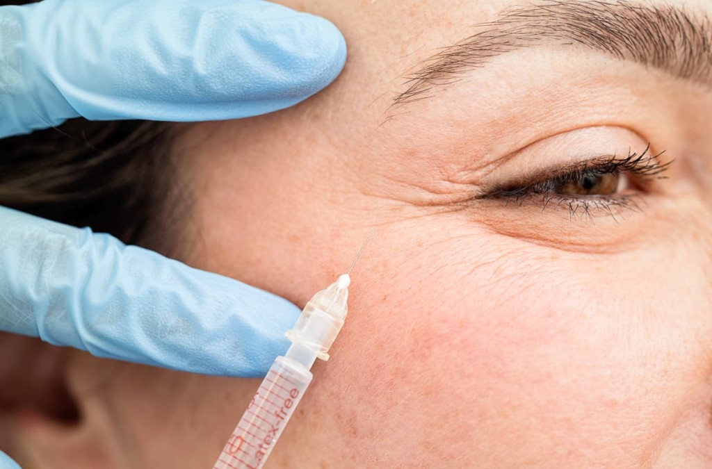 Botox: Herkunft und ästhetische Revolution