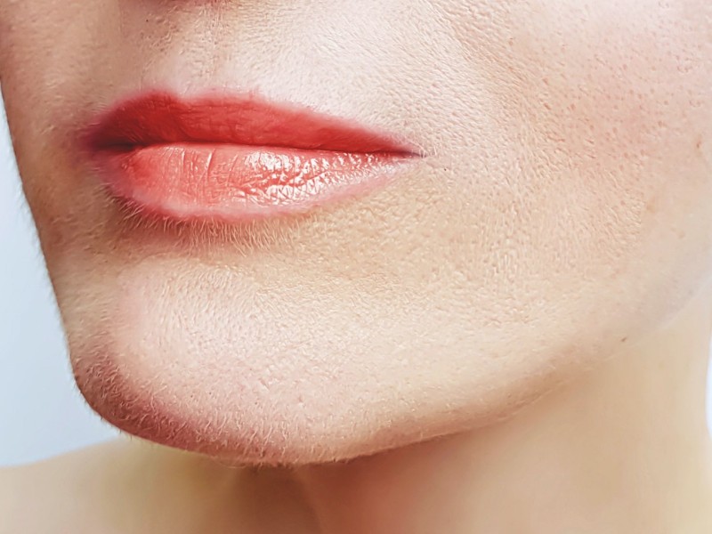 Lippen aufspritzen lassen Dermatologikum Bremen