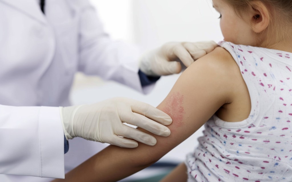 Kinderdermatologie