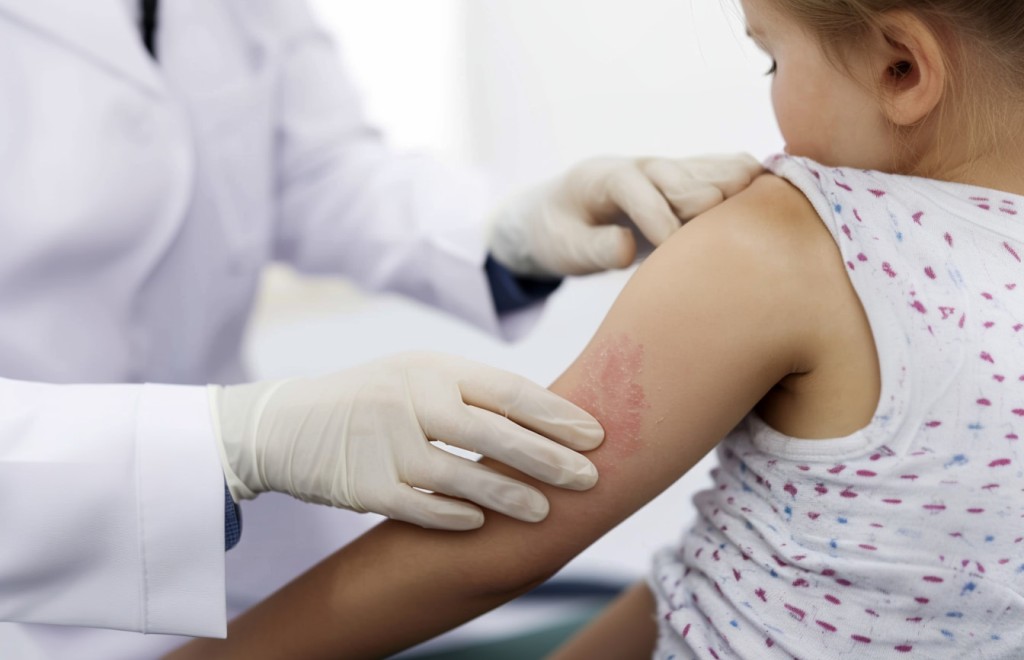 Kinderdermatologie